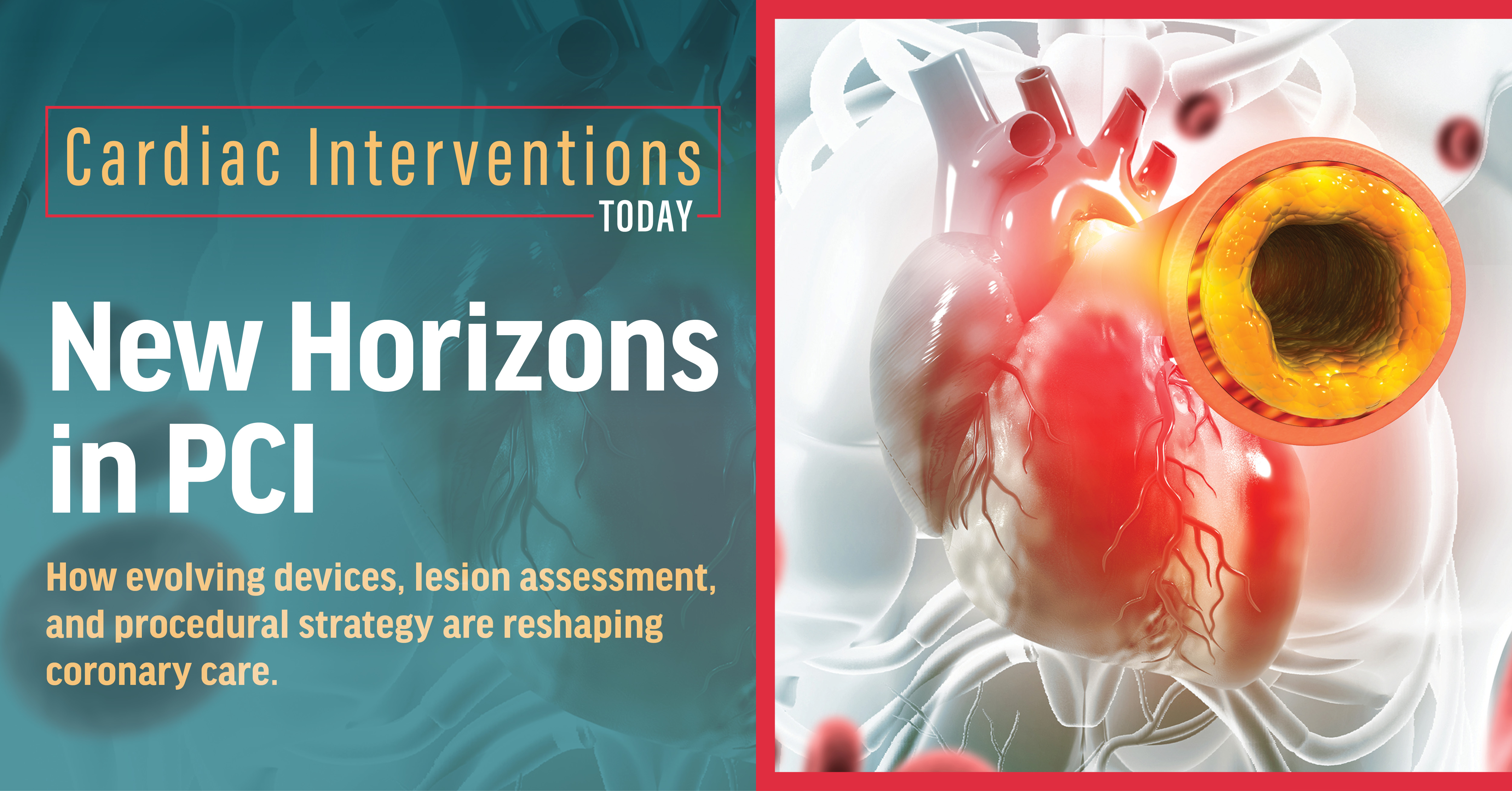 New PCI Directions - Cardiac Interventions Today
